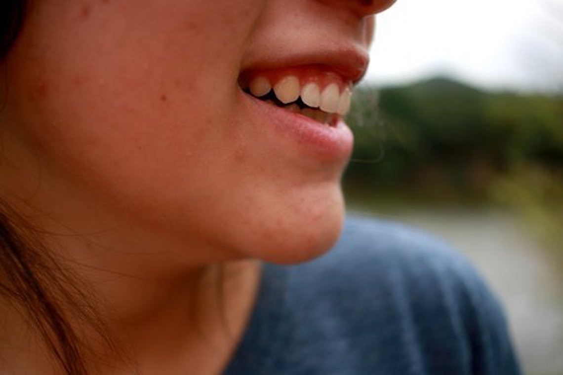 Immagine copertina del consiglio 'Falsi miti dell'acne'